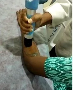 Shock Wave Therapy in Attapur